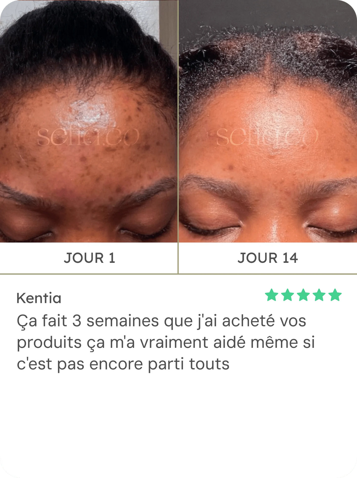 Coton Nettoyant au Curcuma