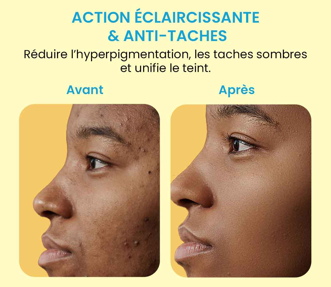 Coton Nettoyant au Curcuma