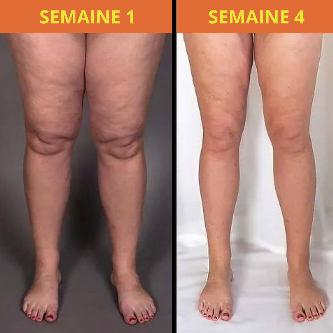 Masseur Plantaire Ultra Puissant